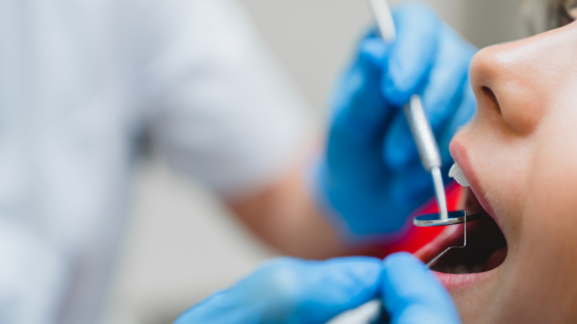 Operating teeth tooth, filling mouth cavity against caries decay dentist in dental clinic.